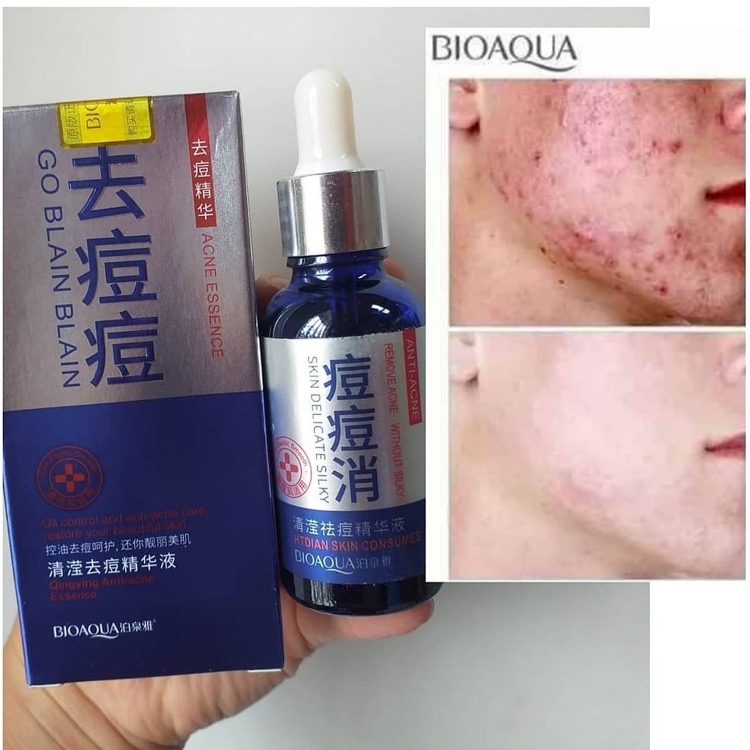 Serum anti acne y control de grasa