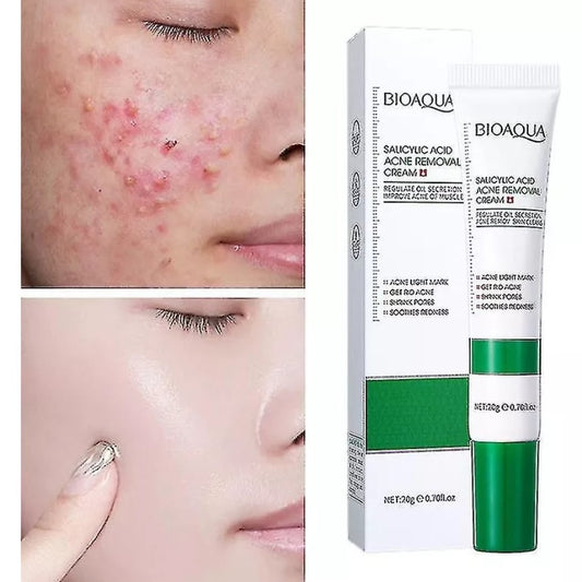 Crema Acido Salicílico anti-imperfecciones