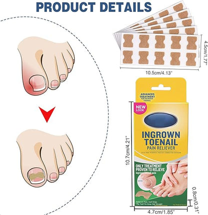 Kit de uñas encarnadas