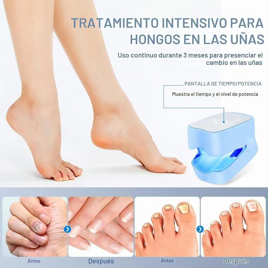 Dispositivo para tratamiento de hongos en uñas