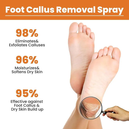 Spray removedor de callos